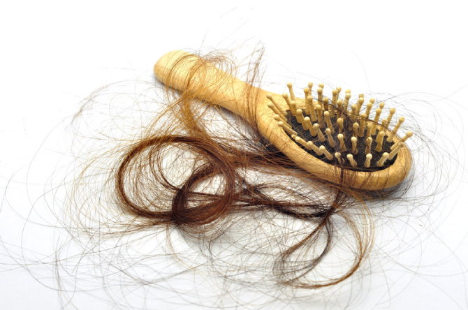 Hair Loss Experts in Lisburn, County Antrim